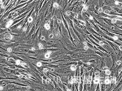 人胚肺成纤维细胞（HFL1）