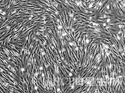 人胚肺成纤维细胞（HFL1）