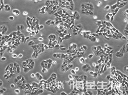 人卵巢癌细胞（OVCAR-8）