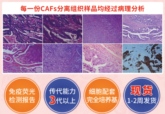 肿瘤相关成纤维细胞(CAFs)仅需3580元