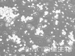 人小细胞肺癌细胞（SHP-77）