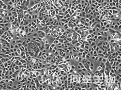 人卵巢癌细胞(NIH-OVCAR-3)