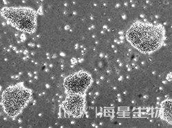 人淋巴母细胞(EBV 转化)(NCI-BL2009)