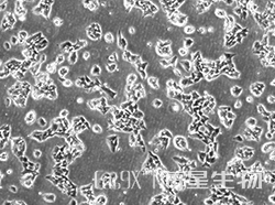 人肾上腺皮质癌细胞(NCI-H295R)