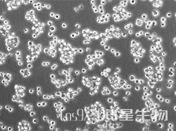 EBV 转化淋巴细胞系(AKATA)