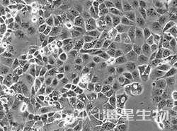 人子宫内膜腺癌细胞(HEC-1-A)