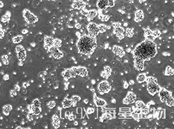 人弥漫性大B淋巴瘤细胞(TMD8)