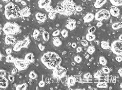 人结肠癌腺癌细胞(CCK-81)