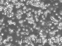 小鼠髓性白血病淋巴细胞(M-NFS-60)