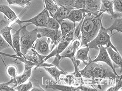 人肺腺癌细胞（NCI-H1975 ）