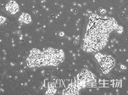 人小细胞肺癌细胞(NCI-H209)