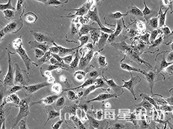 人肾透明细胞腺癌细胞（786-O）