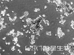 人肺腺癌细胞(NCI-H2122)