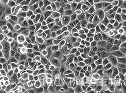 人大细胞肺癌细胞(NCI-H661)