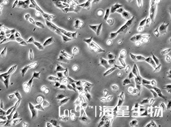 人乳腺癌细胞(HCC1395)