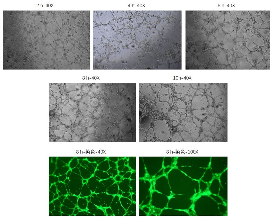 人脐静脉内皮细胞(HUVEC)血管形成实验参考.jpg