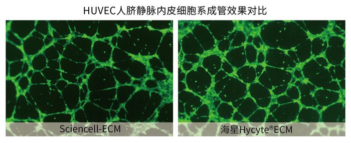 HUVEC人脐静脉内皮细胞系成管效果对比.jpg