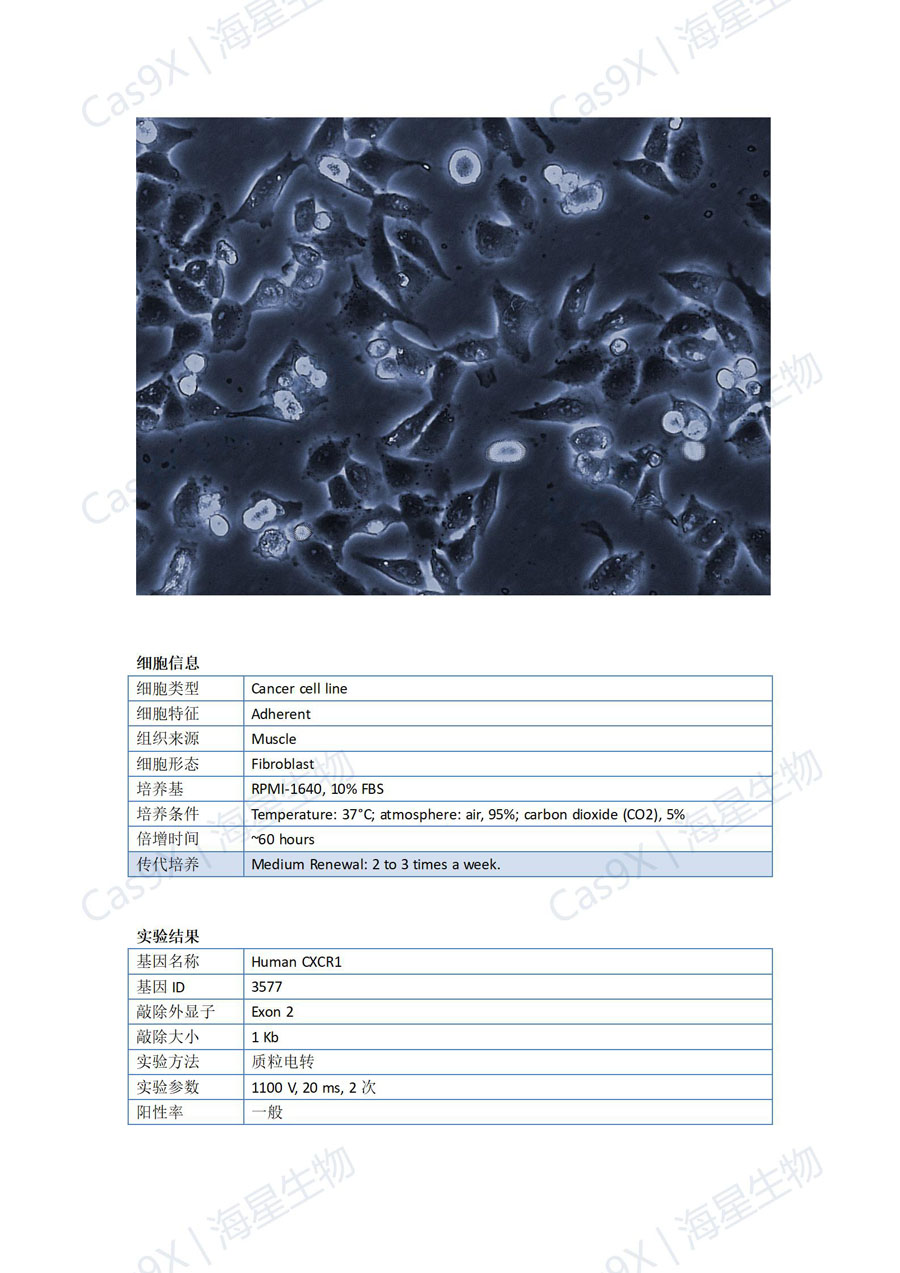 人横纹肌肉瘤细胞(RH30)CXCR1_01.jpg