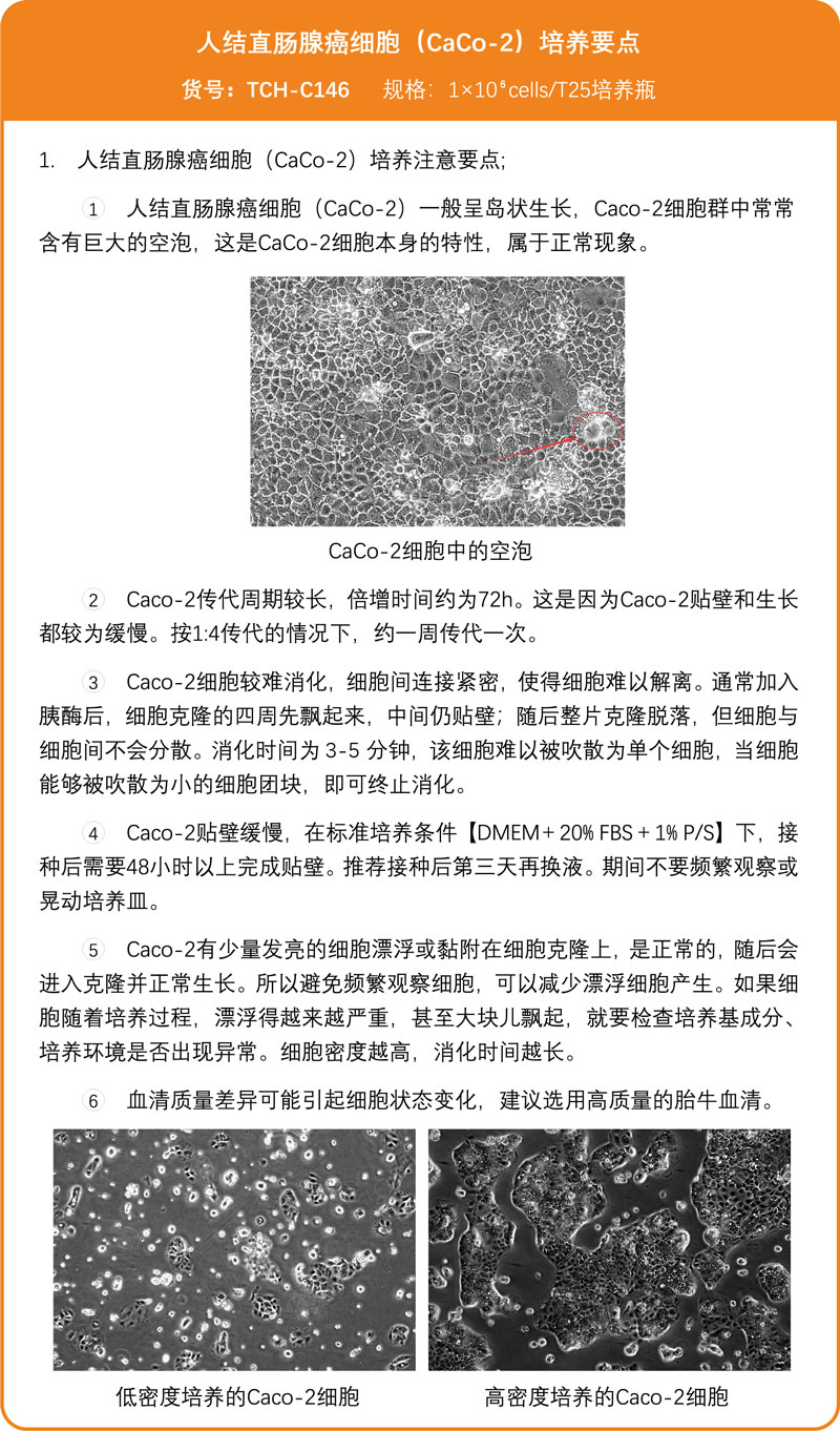 /ueditor/image/2026/03/12/db51b583c628b5974eda21aeaab49033.jpg CaCo-2培养要点.jpg